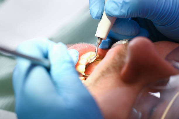Best Emergency Treatment for Jaw Pain or Injury in North Gates, NY