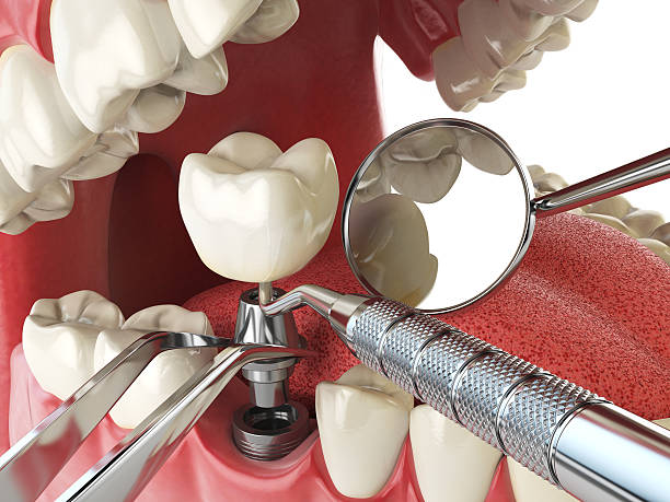 Best Emergency Denture Repair in North Gates, NY